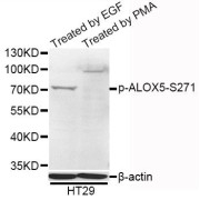 Western blot analysis of extracts of HT-29 cells, using Phospho-ALOX5-S271 antibody (abx123322) at 1/1000 dilution. HT-29 cells were treated by PMA/TPA (200nM).