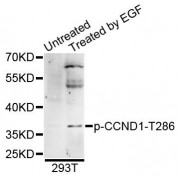 Western blot analysis of extracts of 293T cells, using Phospho-CCND1-T286 antibody (abx123323) at 1/1000 dilution.