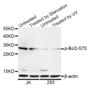 Western blot analysis of extracts of Jurkat and 293 cells, using Phospho-Bcl2 -S70 antibody (abx123324) at 1/1000 dilution. Jurkat cells were treated by serum-starvation overnight. 293 cells were treated by UV for 15-30 minutes.