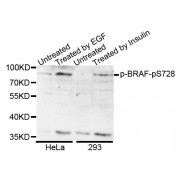 Western blot analysis of extracts of various cell lines, using Phospho-BRAF-S728 antibody (abx123325).