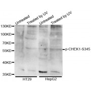 Western blot analysis of extracts of various cell lines, using Phospho-CHEK1-S345 antibody (abx123327).