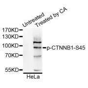 Western blot analysis of extracts of HeLa cells, using Phospho-CTNNB1-S45 antibody (abx123329) at 1/1000 dilution.