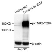 Western blot analysis of extracts of HepG2 cells, using Phospho-TNK2-Y284 antibody (abx123337) at 1/1000 dilution. HepG2 cells were treated by EGF (100ng/ml) for 30 minutes after serum-starvation overnight.