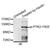 Western blot analysis of extracts of Jurkat cell line, using Phospho-PTK2-Y925 antibody (abx123345).