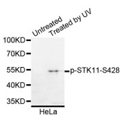 Western blot analysis of extracts of HeLa cells, using Phospho-STK11-S428 antibody (abx123348).