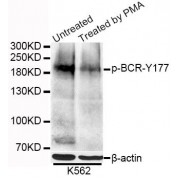 Western blot analysis of extracts of K-562 cells, using Phospho-BCR-Y177 antibody (abx123352) at 1/1000 dilution. K562 cells were treated by PMA/TPA (200nM).