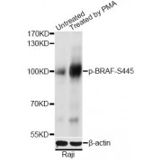 Western blot analysis of extracts of Raji cells, using Phospho-BRAF-S445 antibody (abx123362) at 1/2000 dilution. Raji cells were treated by PMA/TPA (200nM) for 30 minutes.