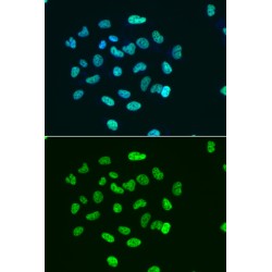 Histone H3 Acetyl-Lys9 (H3 AcK9) Antibody