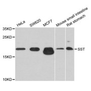 Western blot analysis of extracts of various cell lines, using SST antibody (abx123475) at 1/1000 dilution.