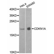 Western blot analysis of extracts of various cell lines, using CDKN1A antibody (abx123507) at 1/1000 dilution.