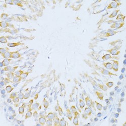 Cyclin Dependent Kinase Inhibitor 1A (CDKN1A) Antibody