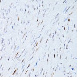 Cyclin Dependent Kinase Inhibitor 1A (CDKN1A) Antibody