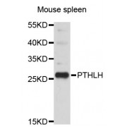 Western blot analysis of extracts of mouse spleen, using PTHLH antibody (abx123517).