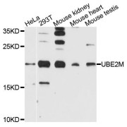 Western blot analysis of extracts of various cell lines, using UBE2M antibody (abx123524) at 1/1000 dilution.