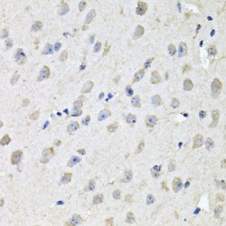 Coiled-Coil-Helix-Coiled-Coil-Helix Domain Containing 3 (CHCHD3) Antibody