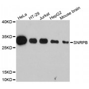 Western blot analysis of extracts of various cell lines, using SNRPB antibody (abx123570) at 1:3000 dilution.