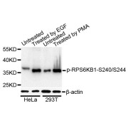 Western blot analysis of extracts of HeLa and 293T cells, using Phospho-RPS6KB1-S240/244 antibody (abx123582) at 1/1000 dilution. HeLa cells were treated by EGF (100ng/ml) for 30 minutes after serum-starvation overnight. 293T cells were treated by PMA/TPA (200nM) for 30 minutes after serum-starvation overnight.