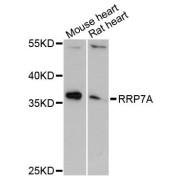 Western blot analysis of extracts of various cell lines, using RRP7A antibody (abx123609) at 1:3000 dilution.