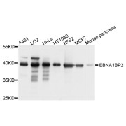 Western blot analysis of extracts of various cell lines, using EBNA1BP2 antibody (abx123650) at 1/1000 dilution.