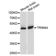 Western blot analysis of extracts of various cell lines, using TRIM44 antibody (abx123696) at 1/1000 dilution.