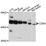 Western blot analysis of extracts of various cell lines, using CDK9 antibody (abx123725) at 1/1000 dilution.