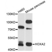 Western blot analysis of extracts of various cell lines, using HOXA2 antibody (abx123730) at 1/1000 dilution.