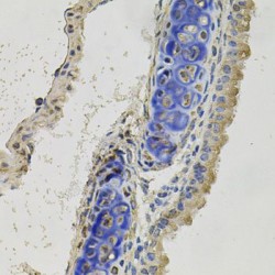 Inhibin Beta B (INHBB) Antibody