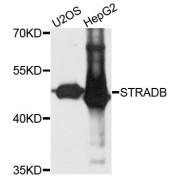 Western blot analysis of extracts of various cell lines, using STRADB antibody (abx123775) at 1/1000 dilution.