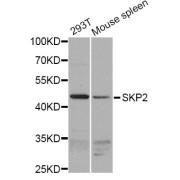 Western blot analysis of extracts of various cell lines, using SKP2 antibody (abx123784) at 1/1000 dilution.