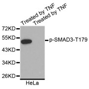 Western blot analysis of extracts of HeLa cell line, using Phospho-SMAD3-T179 antibody (abx123787). The lane on the right is treated with the antigen-specific peptide.