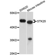 Western blot analysis of extracts of various cell lines, using STK25 antibody (abx123789) at 1/1000 dilution.