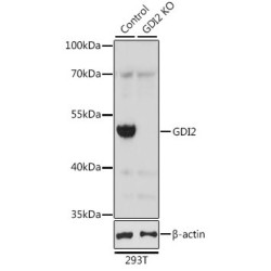 GDP Dissociation Inhibitor 2 (GDI2) Antibody