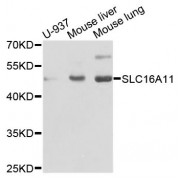 Western blot analysis of extracts of various cell lines, using SLC16A11 antibody (abx123806) at 1/1000 dilution.