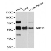 Western blot analysis of extracts of various cell lines, using NUP50 antibody (abx123832) at 1:3000 dilution.