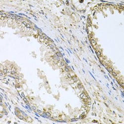 Cholesterol 24-Hydroxylase (CYP46A1) Antibody