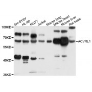 Western blot analysis of extracts of various cell lines, using ACVRL1 antibody (abx123868) at 1/1000 dilution.