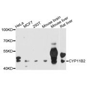 Western blot analysis of extracts of various cell lines, using CYP11B2 antibody (abx123869) at 1/1000 dilution.