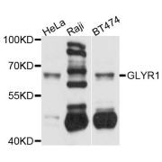 Western blot analysis of extracts of various cell lines, using GLYR1 antibody (abx123916) at 1/1000 dilution.