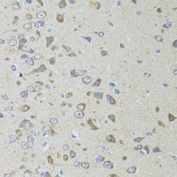 Apoptosis-Inducing Factor 3 (AIFM3) Antibody