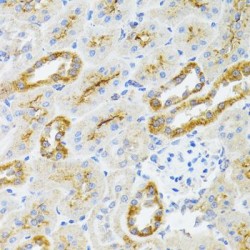 Apoptosis-Inducing Factor 3 (AIFM3) Antibody