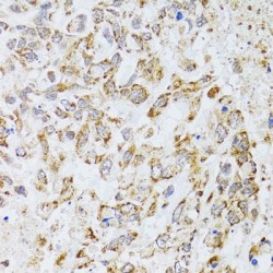 Apoptosis-Inducing Factor 3 (AIFM3) Antibody