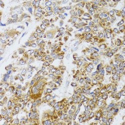 Apoptosis-Inducing Factor 3 (AIFM3) Antibody