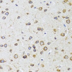 Apoptosis-Inducing Factor 3 (AIFM3) Antibody