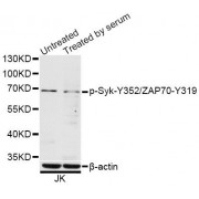 Western blot analysis of extracts of Jurkat cells, using Phospho-Syk-Y352/ZAP70-Y319 antibody (abx123976) at 1/1000 dilution. Jurkat cells were treated by 10% FBS for 30 minutes after serum-starvation overnight.