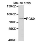 Western blot analysis of extracts of mouse brain, using RGS9 antibody (abx124009) at 1/1000 dilution.