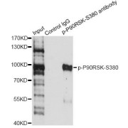 Immunoprecipitation analysis of 200 µg extracts of HeLa cells treated by EGF using 2.5 µg Phospho-P90RSK-S380 antibody (abx124045). Western blot was performed from the immunoprecipitate using Phospho-P90RSK-S380 antibody (abx124045) at a dilition of 1/1000.