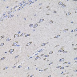 Transmembrane Channel-Like Protein 1 (TMC1) Antibody