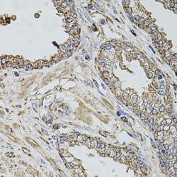 Transmembrane Channel-Like Protein 1 (TMC1) Antibody