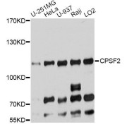 Western blot analysis of extracts of various cell lines, using CPSF2 antibody (abx124069) at 1:7000 dilution.