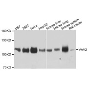 Western blot analysis of extracts of various cell lines, using VAV2 antibody (abx124101) at 1:3000 dilution.